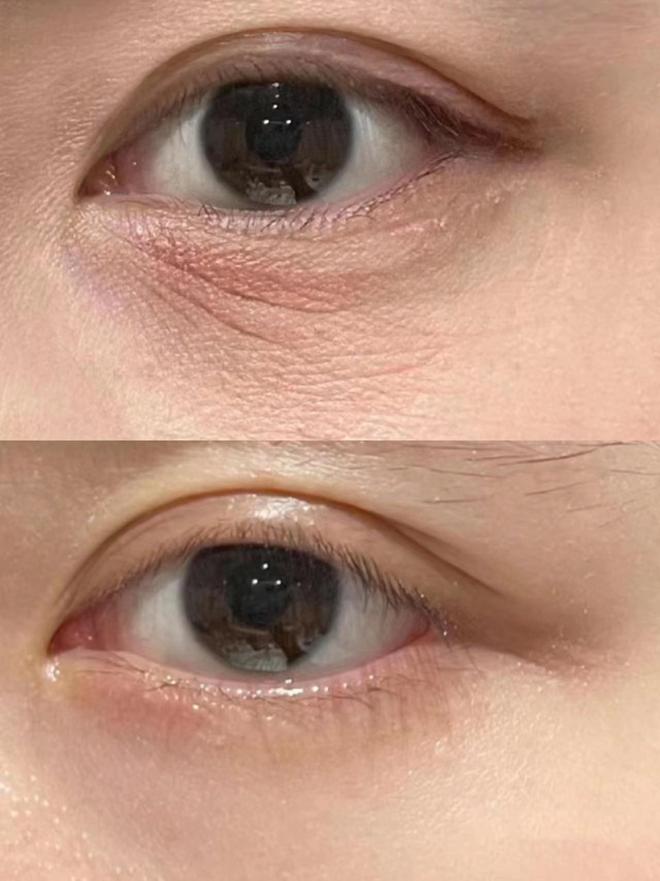 吗？性价比王者万纹可淡的抗皱眼霜测评AG旗舰厅网站眼袋用眼霜真的能去掉(图7)